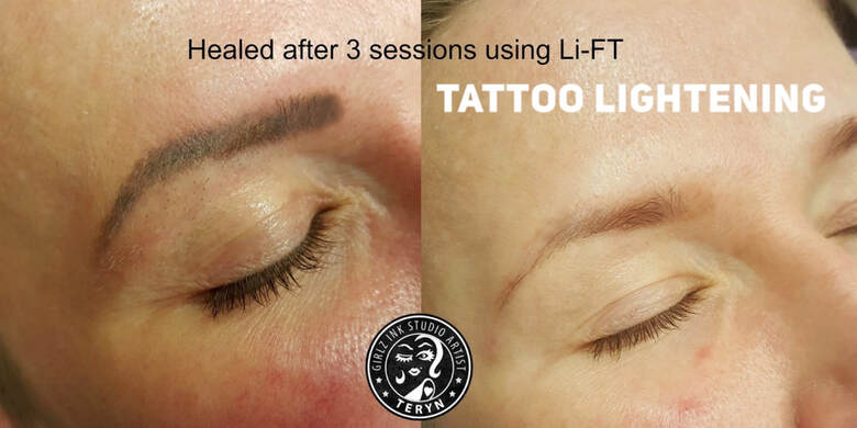 Tattoo Removal Archives  Strokes of Genius Microblading